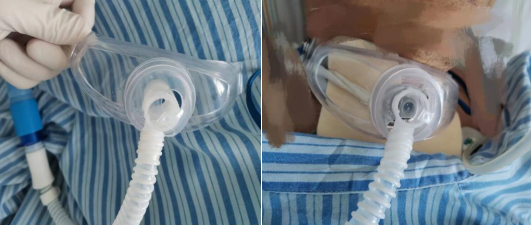 神经外科提升优质服务改善护理质量的举措(图2) 神经外科提升优质服务改善护理质量的举措(图2)