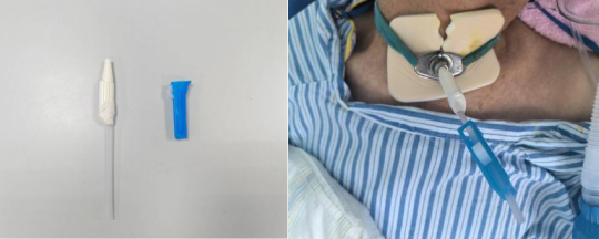 神经外科提升优质服务改善护理质量的举措(图3) 神经外科提升优质服务改善护理质量的举措(图3)