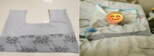 神经外科提升优质服务改善护理质量的举措(图4) 神经外科提升优质服务改善护理质量的举措(图4)