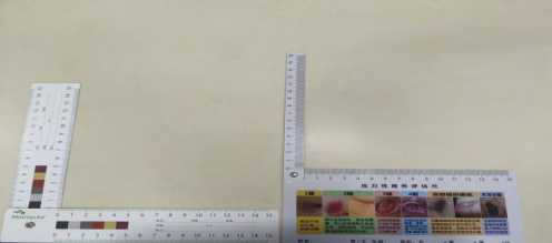 神经外科提升优质服务改善护理质量的举措(图5) 神经外科提升优质服务改善护理质量的举措(图5)